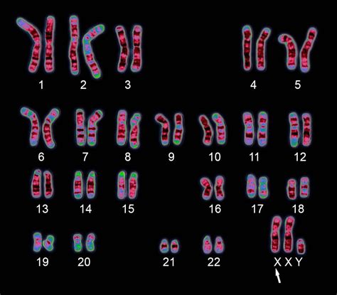 Karyotype | Description, Chromosome Aberration, & Uses | Britannica