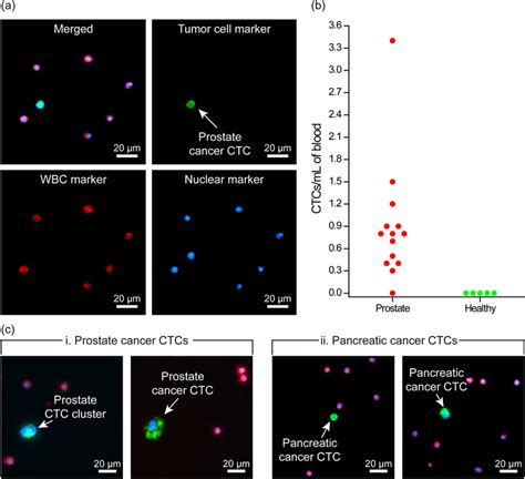 Isolation of circulating tumor cells from clinical samples. (a)... | Download Scientific Diagram