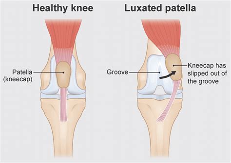 How to Help a Luxating Patella - Canine PT and Me