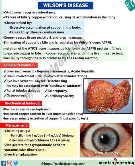 Wilson's Disease | Wilson's disease, Disease symptoms, Disease