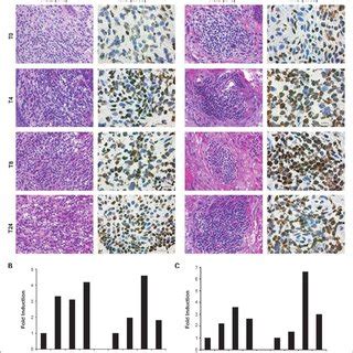 Effects of panobinostat on histone acetylation. A, tumor biopsies from... | Download Scientific ...