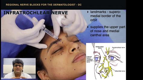 ️ external nasal nerve - YouTube