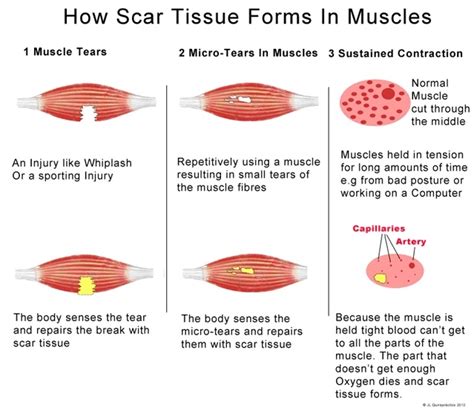 tkr 27 days. who massages their scar? | Knee Problems | Patient