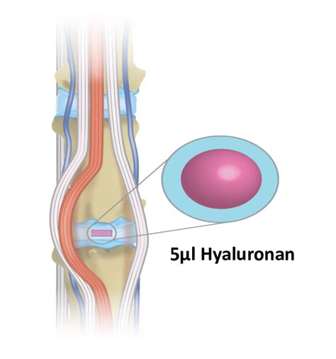 Rat tail disc access after making an incision in the skin and pushing... | Download Scientific ...