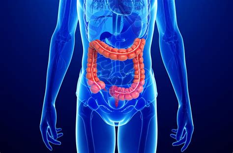 Crohn's disease versus ulcerative colitis: What is the difference?