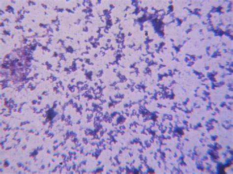 Cureus | Bacterial Colony: First Report of Donut Colony Morphology among Diphtheroids Isolated ...