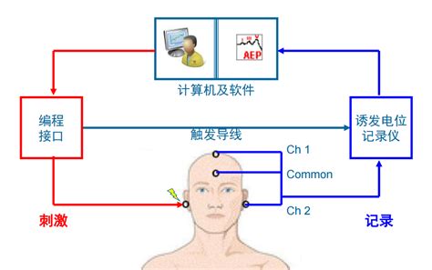 临床听力学技术专业沙龙 | 鲁兆毅：电刺激听觉诱发电位在人工耳蜗植入中的应用 - 知乎