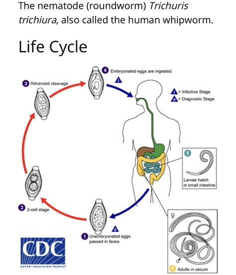 Human Whipworm