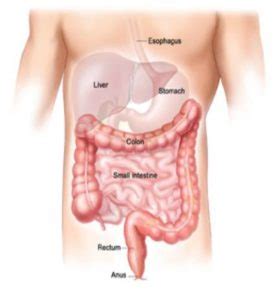 Panproctocolectomy and Ileostomy - Milton Keynes University Hospital