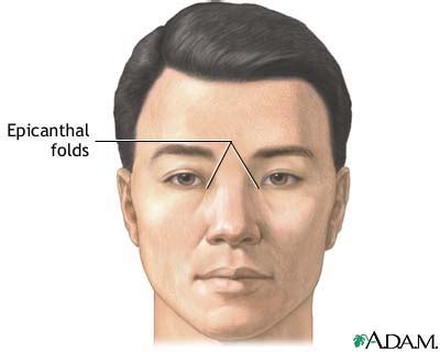 Epicanthal Fold Downs