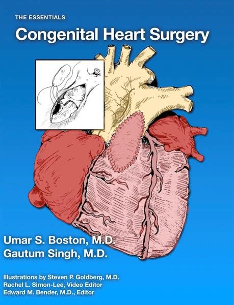 Book Review - The Essentials: Congenital Heart Surgery | CTSNet