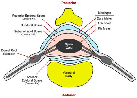 Pin by Elena Gaver on NP - Anatomy | Epidural, Anatomy, Radiology