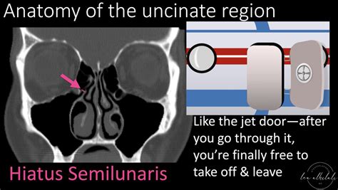 1/Time to FESS up! Do you understand functional endoscopic sinus surgery (FESS)? If you read ...