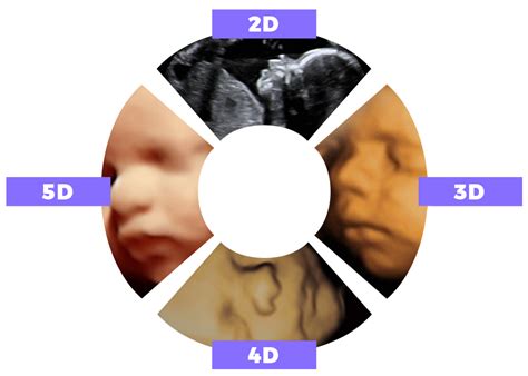 The Difference Between 2D, 3D, 4D, HD and 5D Ultrasound Studio