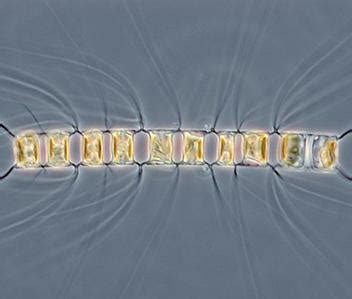 Chaetoceros concavicornis. A chain forming diatom with barbed siliceous... | Download Scientific ...