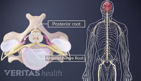 Cervical Spinal Nerves | Spine-health