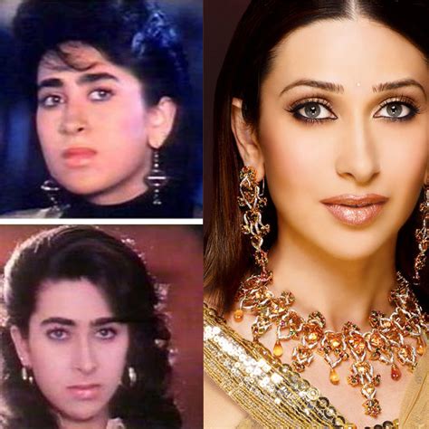 Madhuri Dixit Plastic Surgery : Bollywood Actresses Before And After ...