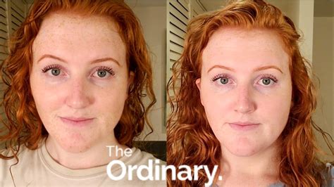 30 Days of only using The Ordinary Skincare | Before & After Results - YouTube