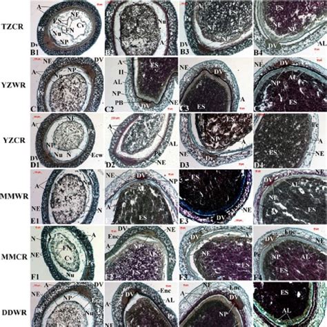 Comparison of endosperm development in weedy rice (Oryza sativa f.... | Download Scientific Diagram