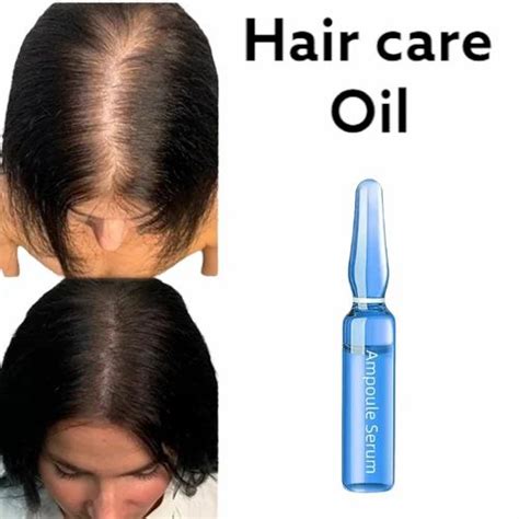 hair growth oil women in long faster women hair growth oil hair fall ...