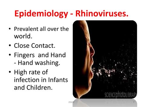 PPT - Rhinovirus by PowerPoint Presentation, free download - ID:3234624