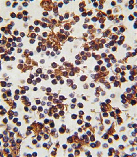 FOXP3 Antibody (PA5-12396)