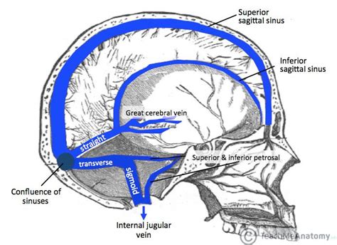 Cerebral venous sinus thrombosis (CVST) is the presence of acute ...