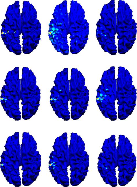 Overviews of brain mapping by different methods at 25 ms. (a) shows the ...