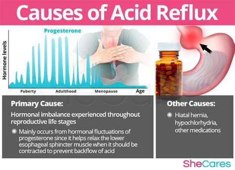 Acid Reflux | SheCares