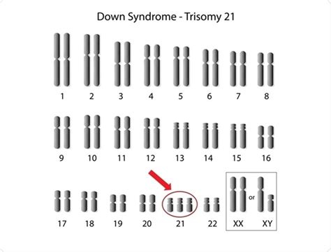 Detecting Aneuploidy Using Flow Cytometry