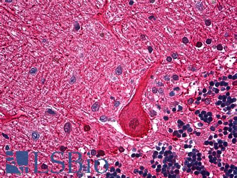 IHCPlus™ CALB1 / Calbindin Polyclonal Antibody Rabbit IHC,WB | LSBio