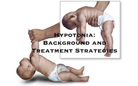 Hyptonia: Exercises to Help Your Baby with Low Muscle Tone - Integrated Learning Strategies