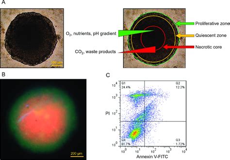 Tumor spheroid characterization. (A) Brightfield image of the tumor ...