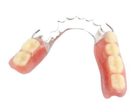 How Do Partial Dentures Stay In? - Dr. Steven C. Hewett D.D.S