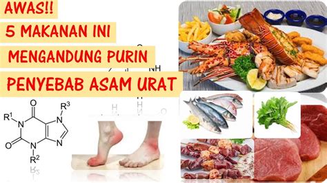 Populer 37+ Makanan Penyebab Asam Urat