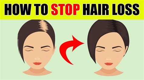 Loss Stop What How To Hair