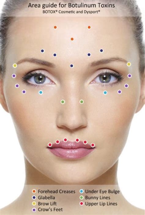 Botox Injection Sites | Botox injection sites, Botox injections, Botox fillers