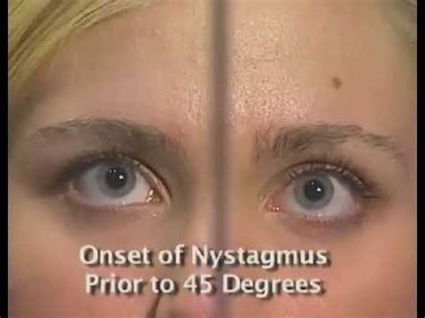 Horizontal Gaze Nystagmus Test - HGN - NHTSA horizontal gaze eye movement test - YouTube