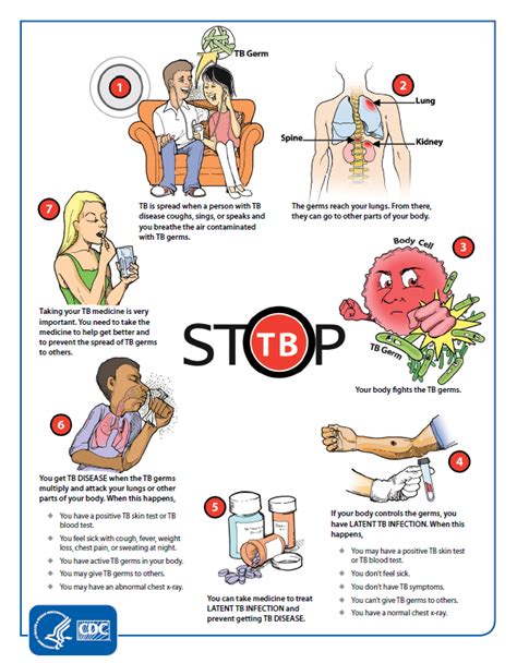 Tuberculosis Control Program | Department of Health | State of Louisiana