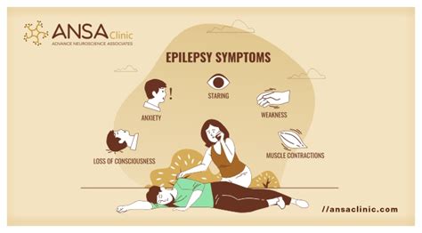 Epilepsy - FergusAshley