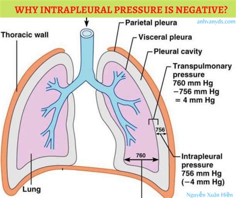 Intrapleural pressure - intrapleural pressure