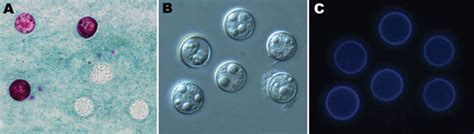 Figure 1 - Prevalence and Molecular Characterization of Cyclospora cayetanensis, Henan, China ...