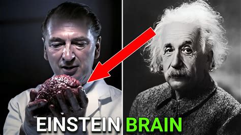 Albert Einstein brain | Albert Einstein brain in museum | How Einstein ...