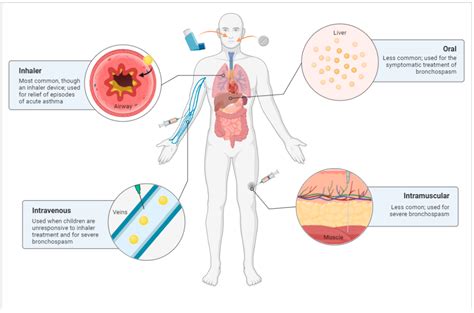 IJMS | Free Full-Text | Salbutamol in the Management of Asthma: A Review