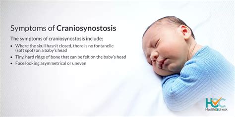 What is Craniosynostosis? – HOC