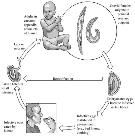 Roundworm-Enterobius (Human Pinworm)