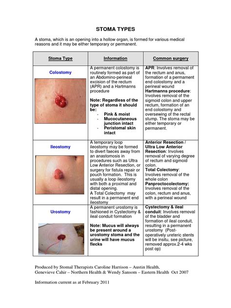 STOMA TYPES.pdf | Gastroenterology | Medical Procedures