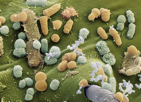 Bacteria and Fungus seen in the Scanning and Transmission Electron Microscope - scientific ...