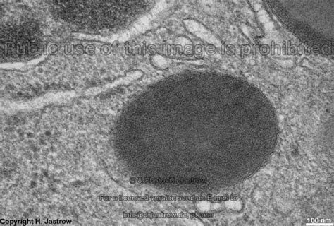 Lysosomes Dr.Jastrow's electron microscopic atlas