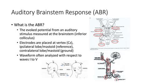 PPT - Auditory Brainstem Response (ABR) PowerPoint Presentation, free ...